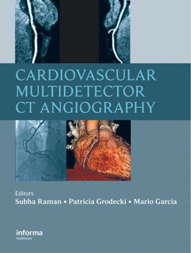 【预订】Cardiovascular Multidetector CT Angiography