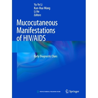 预订 Mucocutaneous Manifestations of HIV/AIDS: Early Diagnostic Clues HIV/AIDS 的皮肤黏膜表现: 9789811554698