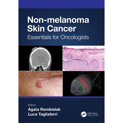 预订 Non-melanoma Skin Cancer Essentials for Oncologists 非黑素瘤皮肤癌:适合肿瘤学家的要点 9781032127415