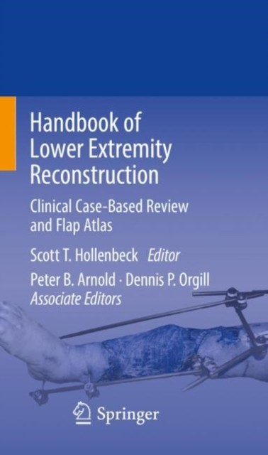 【预订】handbook of lower extremity reconstruction