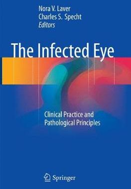 预订 The Infected Eye