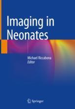 【预订】Imaging in Neonates 9783031157288