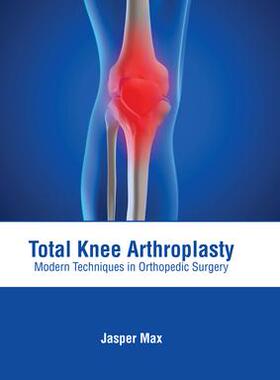 [预订]Total Knee Arthroplasty: Modern Techniques in Orthopedic Surgery 9781639274055