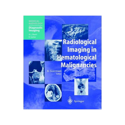 预订 Radiological Imaging in Hematological Malignancies