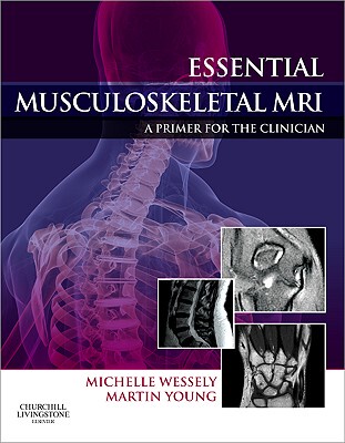 【预订】Essential Musculoskeletal MRI