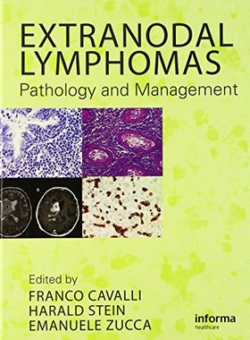 【预订】Extranodal Lymphomas