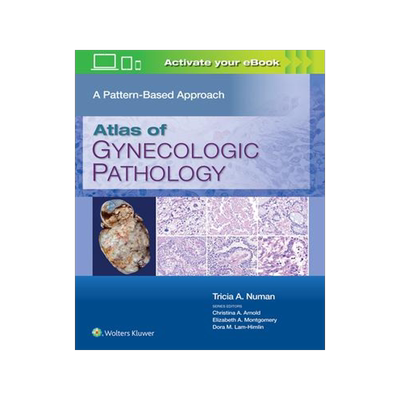 [预订]Atlas of Gynecologic Pathology: A Pattern-Based Approach 9781975124762