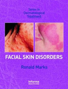 Skin Facial Disorders 预订