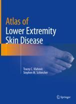【预订】Atlas of Lower Extremity Skin Disease 9783031079498