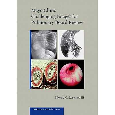预订 Mayo Clinic Challenging Images for Pulmonary Board Review 梅奥诊所针对肺部委员会审查的挑战性图像 9780199756926