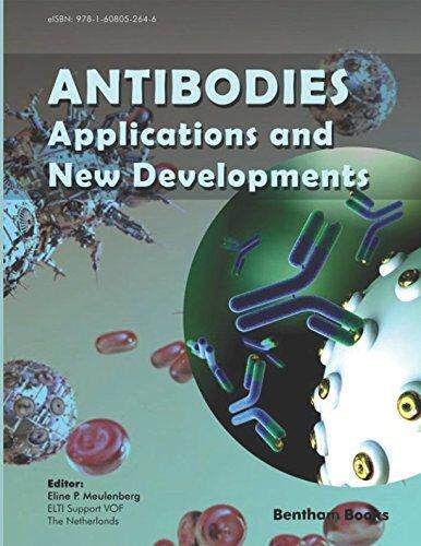 国外库房发货，通常付款后5-8周到货！