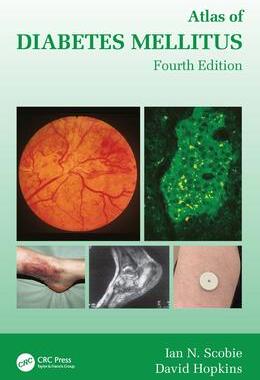 [预订]Atlas of Diabetes Mellitus 9781032379456