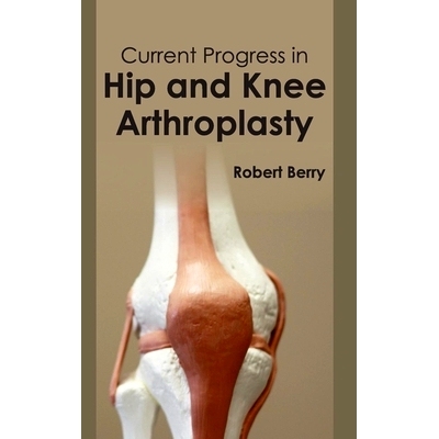 预订 Current Progress in Hip and Knee Arthroplasty 髋膝关节置换术的*进展: 9781632411037