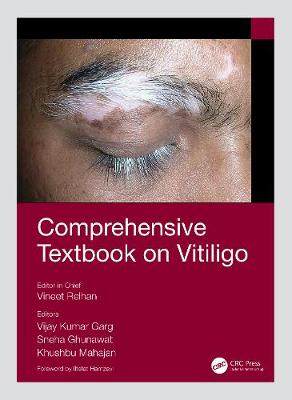 【预订】Comprehensive Textbook on Vitiligo