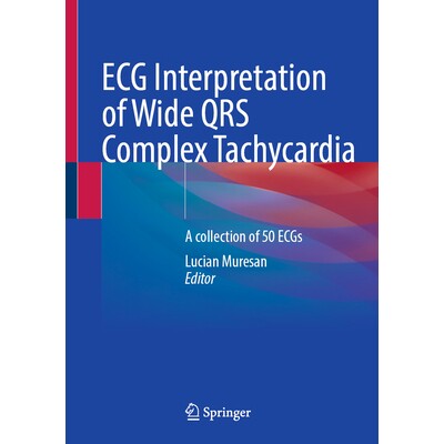 预订 ECG Interpretation of Wide QRS Complex Tachycardia A collection of 50 ECGs 宽QRS波群心动过速的心电图解读:50例心电