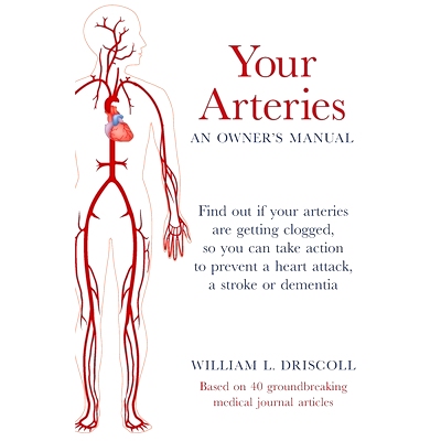 预订 Your Arteries-An Owner's Manual: Find out if your arteries are getting clogged, so you can take action to prevent a