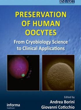 【预订】Preservation of Human Oocytes