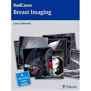 乳腺影像 预订 Imaging Breast 9781604061918 Radcases