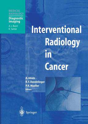 预订 Interventional Radiology in Cancer