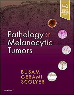 Pathology of Melanocytic Tumors 黑色素细胞瘤病理学