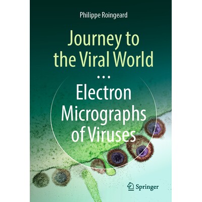 Electron Micrographs of Viruses