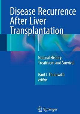 【预订】Disease Recurrence After Liver Transplantation