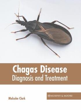 [预订]Chagas Disease: Diagnosis and Treatment 9781639871001
