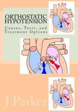 [预订]Orthostatic Hypotension Causes, Tests, and Treatment Options 9781475296884