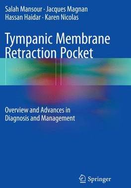 预订 Tympanic Membrane Retraction Pocket