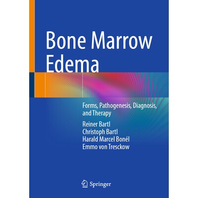 Forms, Pathogenesis, Diagnosis, and Ther