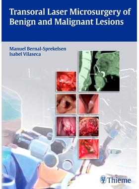 预订 Transoral Laser Microsurgery of Benign and Malignant Lesions 良性和恶性病变激光手术: 9783131723918