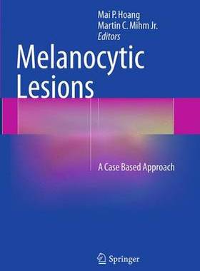 预订 Melanocytic Lesions