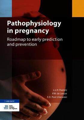 [预订]Pathophysiology of pregnancy complications 9789036825702
