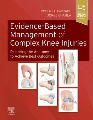 【预订】Evidence-Based Management of Complex Knee Injuries: Restoring the Anatomy to Achieve Best Outcomes