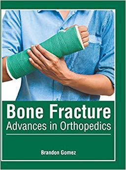 【预售】Bone Fracture: Advances in Orthopedics