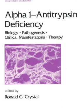 【预订】Alpha 1 - Antitrypsin Deficiency
