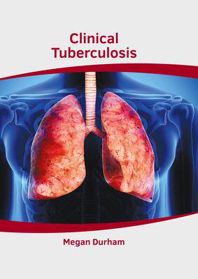 [预订]Clinical Tuberculosis 9781639274581