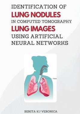 [预订]Identification of Lung Nodules in Computed Tomography Lung Images Using Artificial Neural Networks 9787692280965