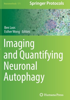 预订 Imaging and Quantifying Neuronal Autophagy