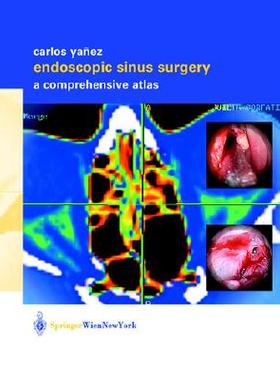 【预订】Endoscopic Sinus Surgery