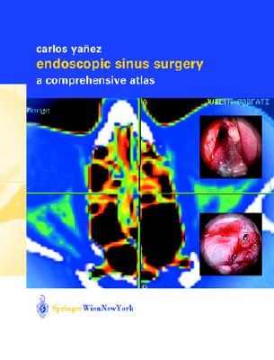 【预订】Endoscopic Sinus Surgery