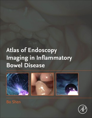 【预订】Atlas of Endoscopy Imaging in Inflammatory Bowel Disease