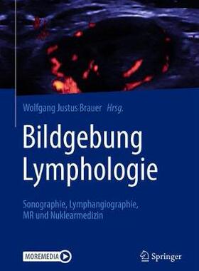 预订 Bildgebung Lymphologie