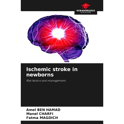 预订 Ischemic stroke in newborns: Risk factors and management 新生兒缺血性中風: 9786208340285