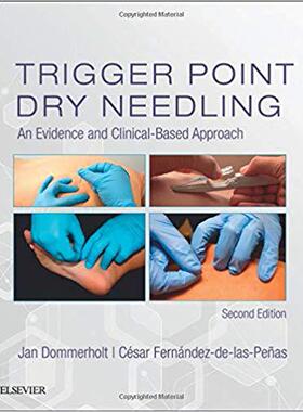 【预售】Trigger Point Dry Needling