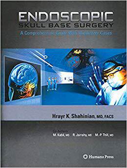 【预订】Endoscopic Skull Base Surgery