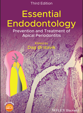 【预订】Essential Endodontology - Prevention and Treatmentof Apical Periodontitis, 3rd Edition