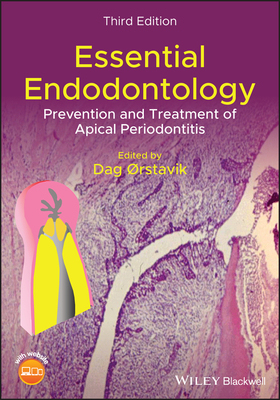 【预订】Essential Endodontology - Prevention and Treatmentof Apical Periodontitis, 3rd Edition