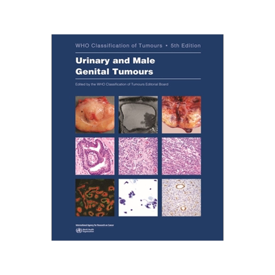 预订 Urinary and Male Genital Tumours