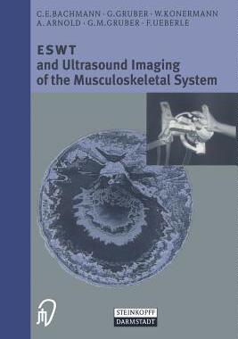 【预订】ESWT and Ultrasound Imaging of the Musculoskeletal System